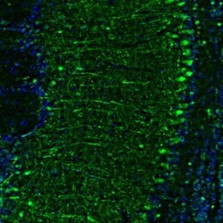 GMF-beta Antibody, Novus Biologicals:Antibodies:Primary Antibodies