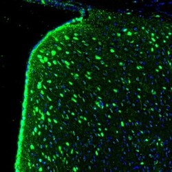GMF-beta Antibody, Novus Biologicals:Antibodies:Primary Antibodies
