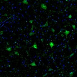 GMF-beta Antibody, Novus Biologicals:Antibodies:Primary Antibodies