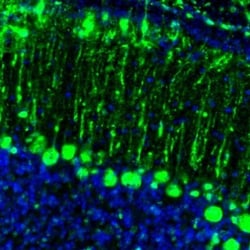 GMF-beta Antibody, Novus Biologicals:Antibodies:Primary Antibodies