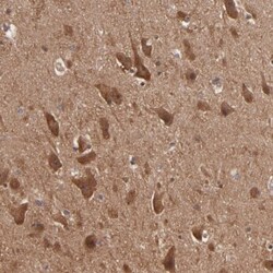 GMF-beta Antibody, Novus Biologicals:Antibodies:Primary Antibodies