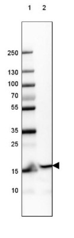 GMF-beta Antibody, Novus Biologicals:Antibodies:Primary Antibodies