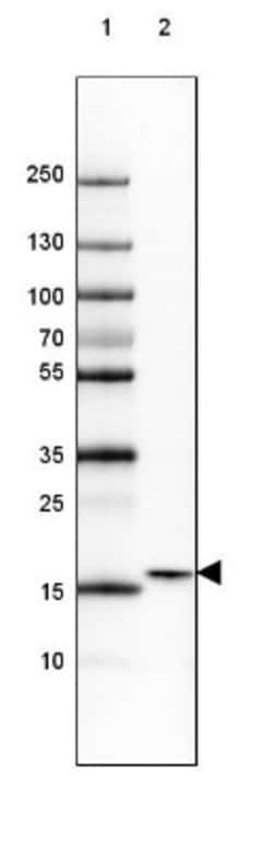 GMF-beta Antibody, Novus Biologicals:Antibodies:Primary Antibodies