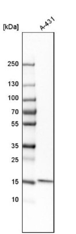 GMF-beta Antibody, Novus Biologicals:Antibodies:Primary Antibodies