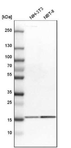 GMF-beta Antibody, Novus Biologicals:Antibodies:Primary Antibodies