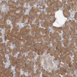 GMPPA Antibody, Novus Biologicals 0.1mL; Unlabeled:Antibodies, Polyclonal