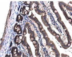 GNAQ Antibody, Novus Biologicals 0.1mL; Unlabeled:Antibodies, Polyclonal
