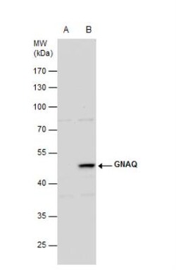 GNAQ Antibody, Novus Biologicals 0.1mL; Unlabeled:Antibodies, Polyclonal