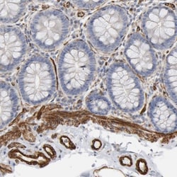 GNG2 Antibody, Novus Biologicals 0.1mL; Unlabeled:Antibodies, Polyclonal