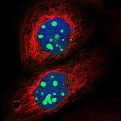 GNL2 Antibody, Novus Biologicals 0.1mL; Unlabeled:Antibodies, Polyclonal