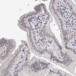 GNL2 Antibody, Novus Biologicals 0.1mL; Unlabeled:Antibodies, Polyclonal