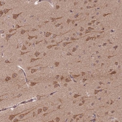 GOLGA3 Antibody, Novus Biologicals 0.1mL; Unlabeled:Antibodies, Polyclonal