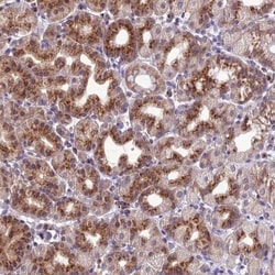 GOLPH3 Antibody, Novus Biologicals 25 &mu;L; Unlabeled:Antibodies, Polyclonal