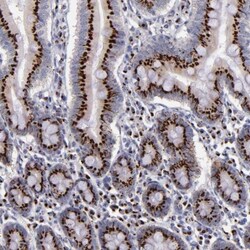 GOLPH4 Antibody, Novus Biologicals 25 &mu;L, Unconjugated:Antibodies, Polyclonal