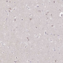 GP2 Antibody, Novus Biologicals 25 &mu;L | Buy Online | Novus Biologicals | Fisher Scientific