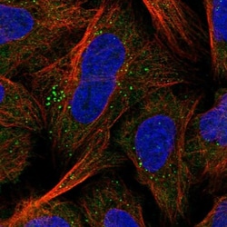 GPBP Antibody, Novus Biologicals 25 &mu;L; Unlabeled:Antibodies, Polyclonal