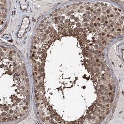 GPBP Antibody, Novus Biologicals 25 &mu;L; Unlabeled:Antibodies, Polyclonal