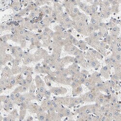 GPD2 Antibody, Novus Biologicals 25 &mu;L; Unlabeled:Antibodies, Polyclonal