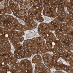 GPD2 Antibody, Novus Biologicals 25 &mu;L; Unlabeled:Antibodies, Polyclonal
