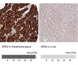 GPD2 Antibody, Novus Biologicals 0.1mL; Unlabeled:Antibodies, Polyclonal