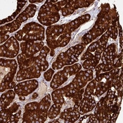 GPD2 Antibody, Novus Biologicals 0.1mL; Unlabeled:Antibodies, Polyclonal
