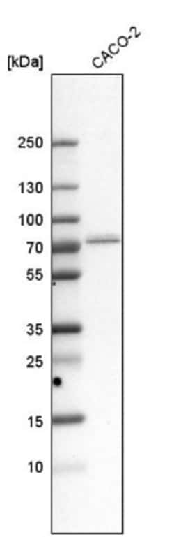 GPD2 Antibody, Novus Biologicals 25 &mu;L; Unlabeled:Antibodies, Polyclonal