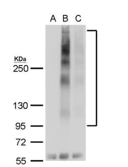 GPER/GPR30 Antibody, Novus Biologicals 0.1mg; Unlabeled:Antibodies, Polyclonal