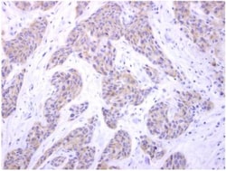 GPI8 Antibody, Novus Biologicals 0.1mL; Unlabeled:Antibodies, Polyclonal