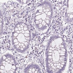 GPIHBP1 Antibody, Novus Biologicals 0.1mL; Unlabeled:Antibodies, Polyclonal