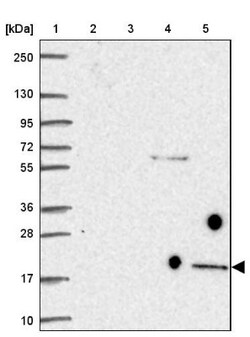 GPIHBP1 Antibody, Novus Biologicals 0.1mL; Unlabeled:Antibodies, Polyclonal