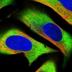 GPIP137 Antibody, Novus Biologicals:Antibodies:Primary Antibodies