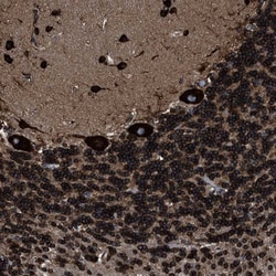 GPIP137 Antibody, Novus Biologicals:Antibodies:Primary Antibodies