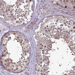 GPN3 Antibody, Novus Biologicals:Antibodies:Primary Antibodies