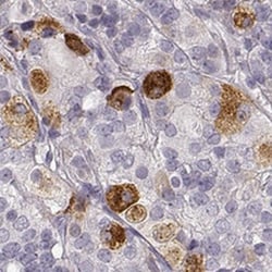 GPR10 Antibody, Novus Biologicals 0.1mL; Unlabeled:Antibodies, Polyclonal