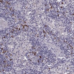 GPR114 Antibody, Novus Biologicals 0.1mL; Unlabeled:Antibodies, Polyclonal