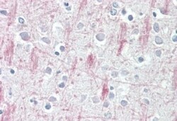 GPR125 Antibody, Novus Biologicals 0.1mg; Unlabeled:Antibodies, Polyclonal