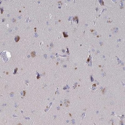 GPR148 Antibody, Novus Biologicals 25 &mu;L, Unlabeled:Antibodies, Polyclonal