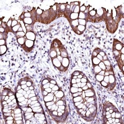 GPR176 Antibody, Novus Biologicals 0.1mL; Unlabeled:Antibodies, Polyclonal