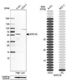 GPR176 Antibody, Novus Biologicals 0.1mL; Unlabeled:Antibodies, Polyclonal