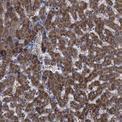 GPR179 Antibody, Novus Biologicals:Antibodies:Primary Antibodies