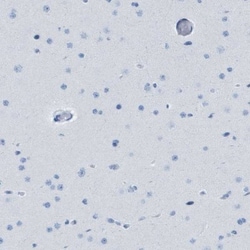 GPR18 Antibody, Novus Biologicals 25 &mu;L; Unlabeled:Antibodies, Polyclonal