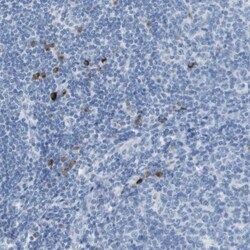 GPR18 Antibody, Novus Biologicals 25 &mu;L; Unlabeled:Antibodies, Polyclonal