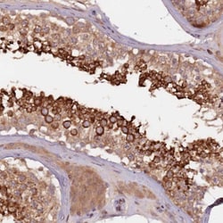 GPR180 Antibody, Novus Biologicals 0.1mL; Unlabeled:Antibodies, Polyclonal