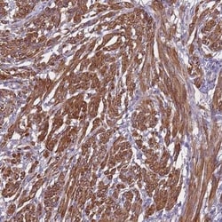 GPR50 Antibody, Novus Biologicals 25 &mu;L, Unlabeled:Antibodies, Polyclonal