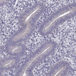 GPR64 Antibody, Novus Biologicals 25 &mu;L; Unlabeled:Antibodies, Polyclonal