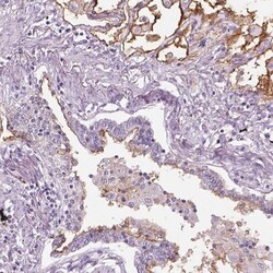 GPRC5A/RAI3 Antibody, Novus Biologicals:Antibodies:Primary Antibodies