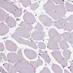 GPRC5A/RAI3 Antibody, Novus Biologicals:Antibodies:Primary Antibodies