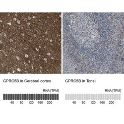 GPRC5B Antibody, Novus Biologicals:Antibodies:Primary Antibodies