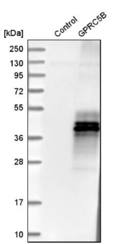 GPRC5B Antibody, Novus Biologicals:Antibodies:Primary Antibodies