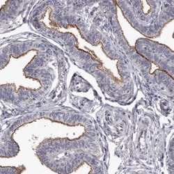 GPRC5C Antibody, Novus Biologicals 25 &mu;L; Unlabeled:Antibodies, Polyclonal